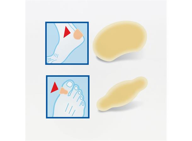 BenPed Vabelplaster 5pk 58 x 23 mm
