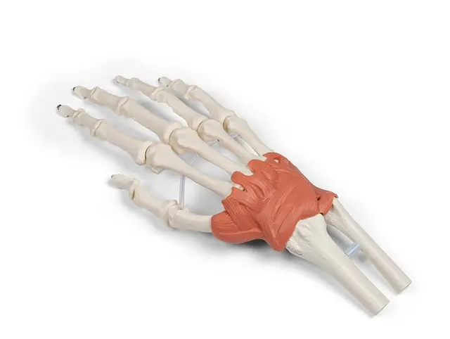 Hånd m/ Ligamenter Håndledd 