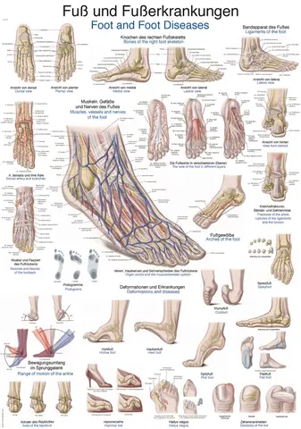 Plakat Foot and foot diseases
